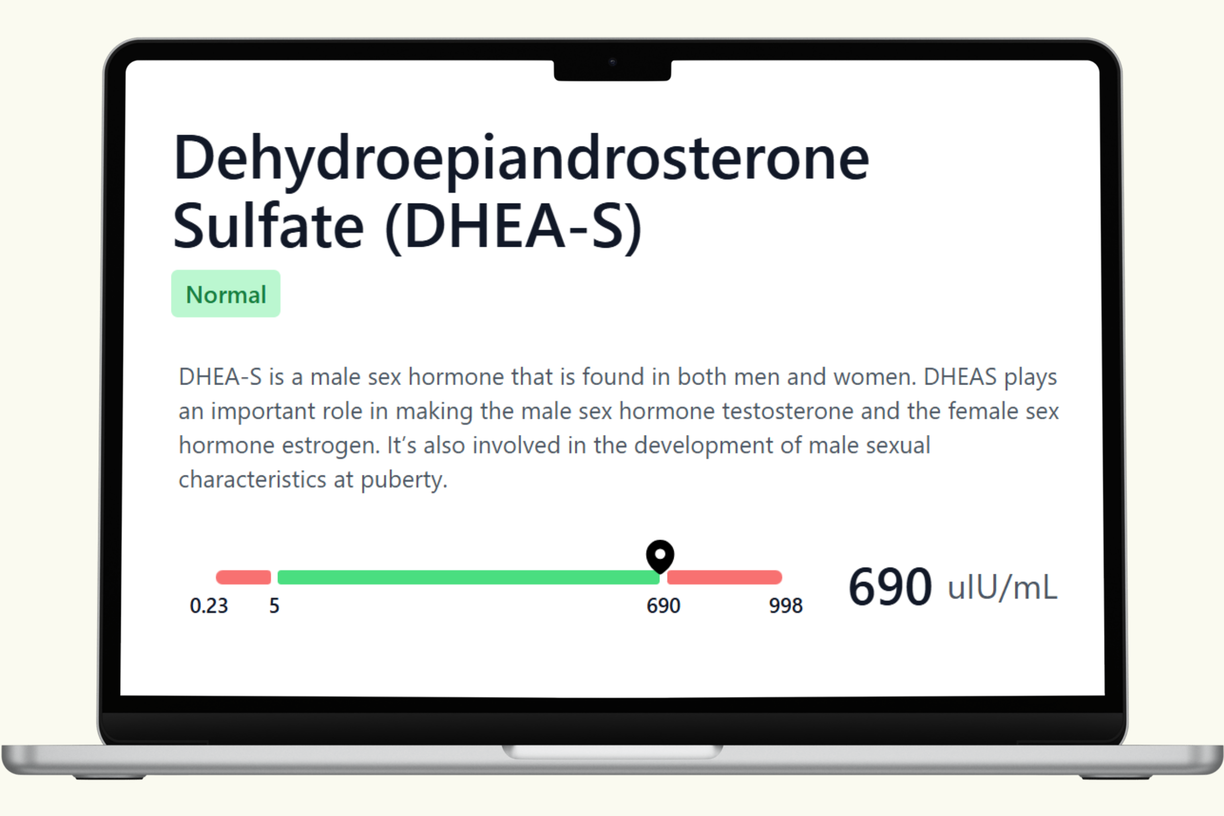 DHEA-S Blood Test