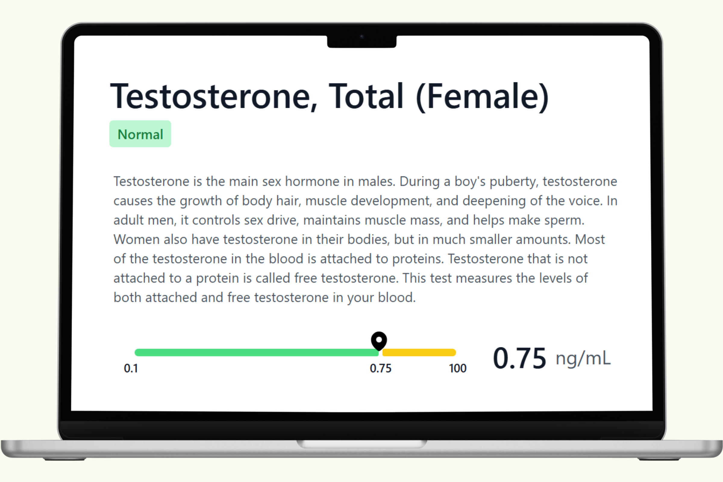 Testosterone (Female) Blood Test