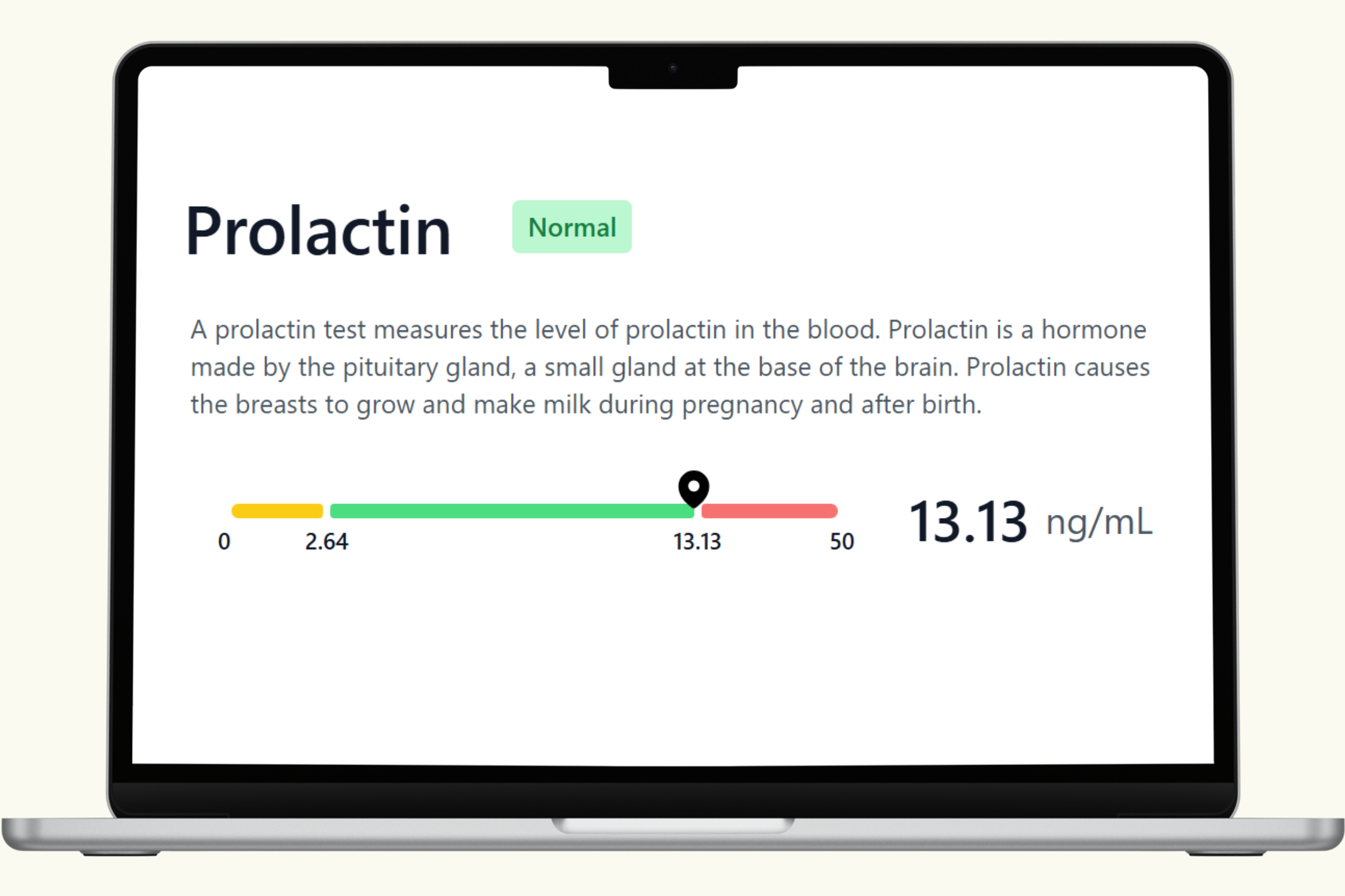 Prolactin (PRL) Blood Test