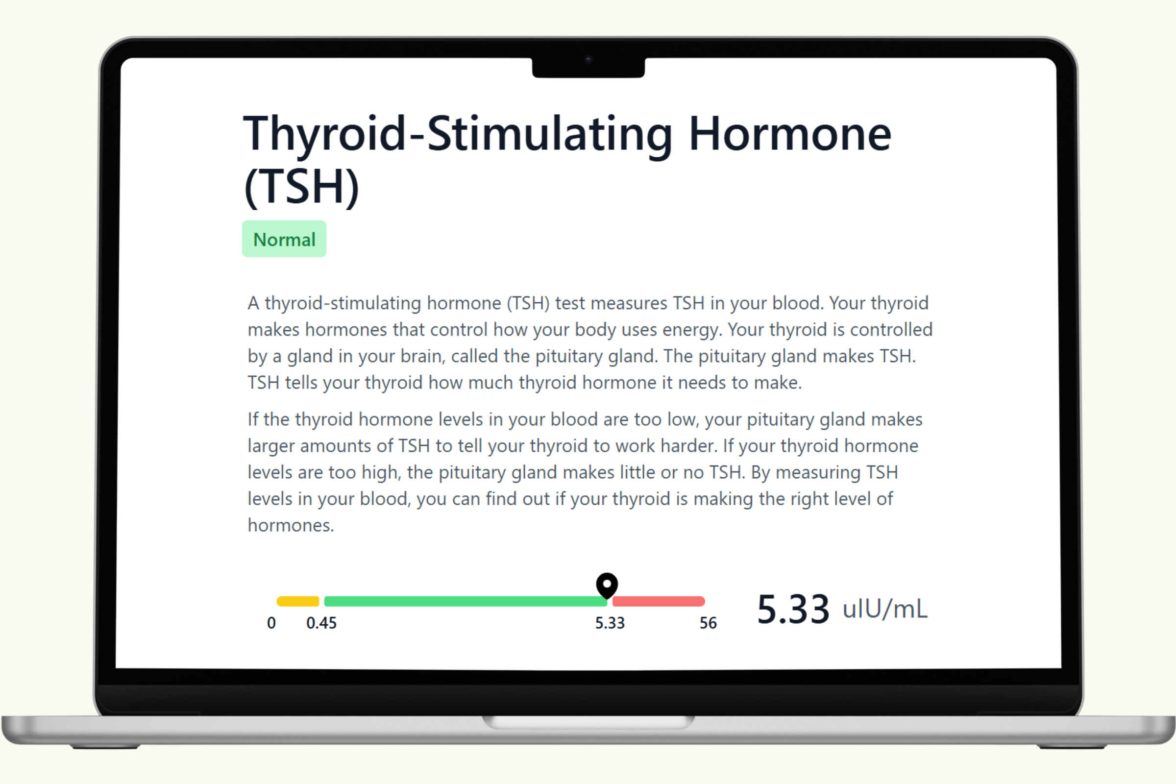 Thyroid-Stimulating Hormone (TSH) Blood Test