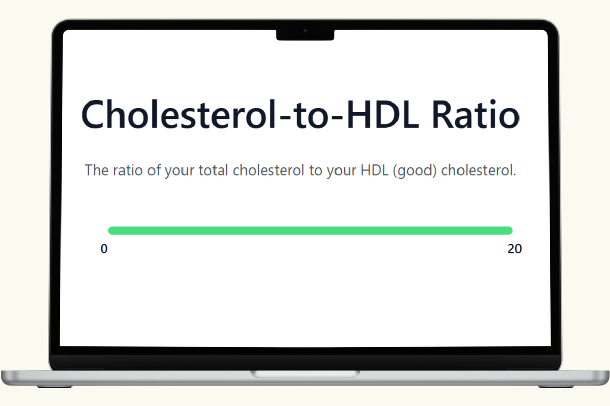 Cholesterol-HDL Ratio Blood Test – PlexusDx