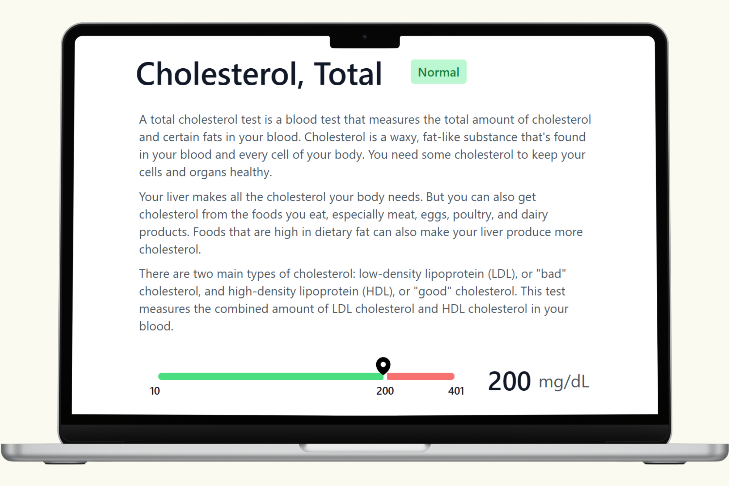 Cholesterol Blood Test