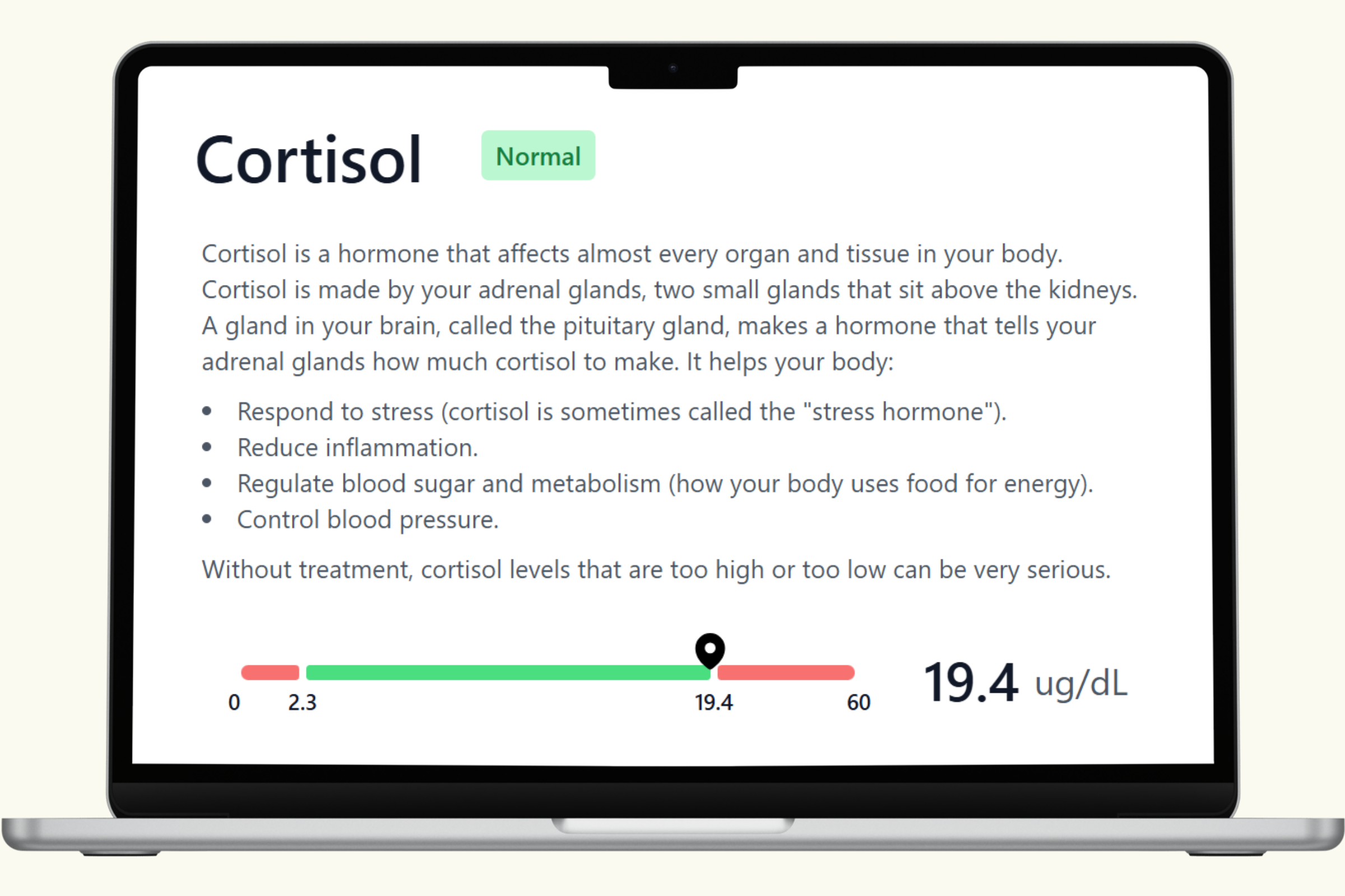 Cortisol Blood Test