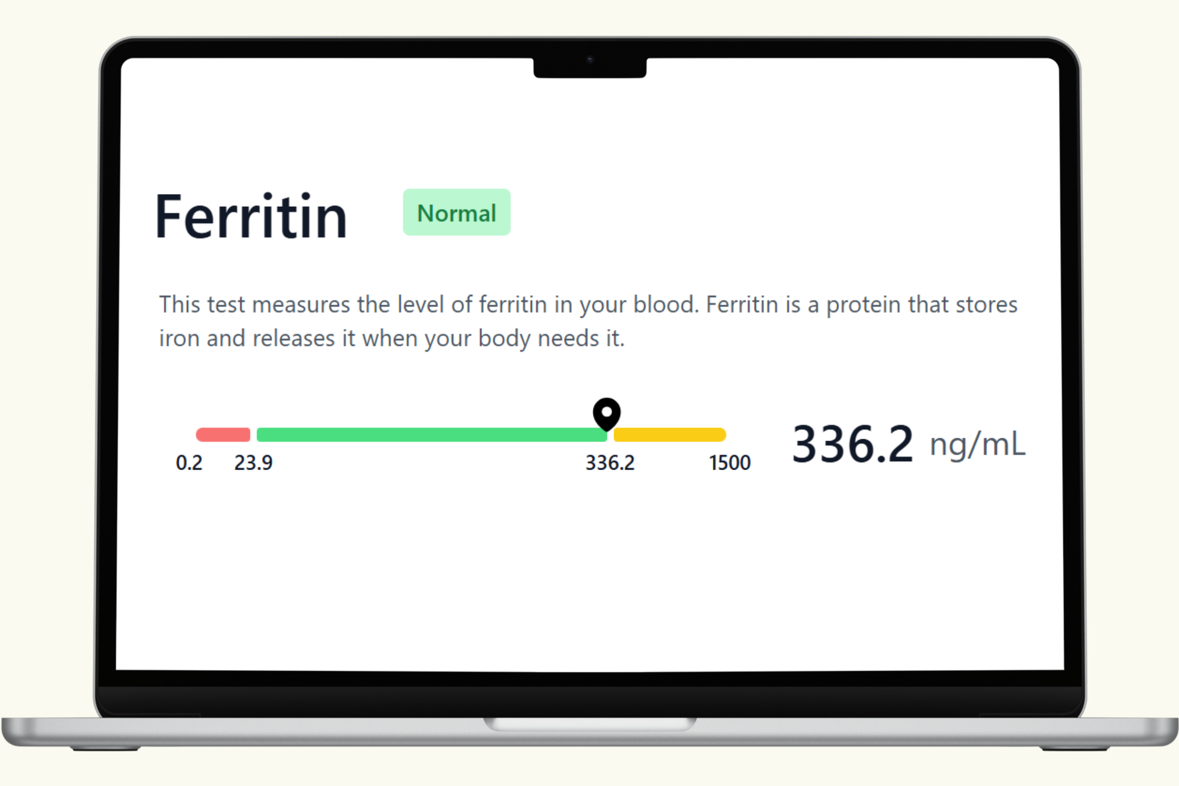 Ferritin Blood Test