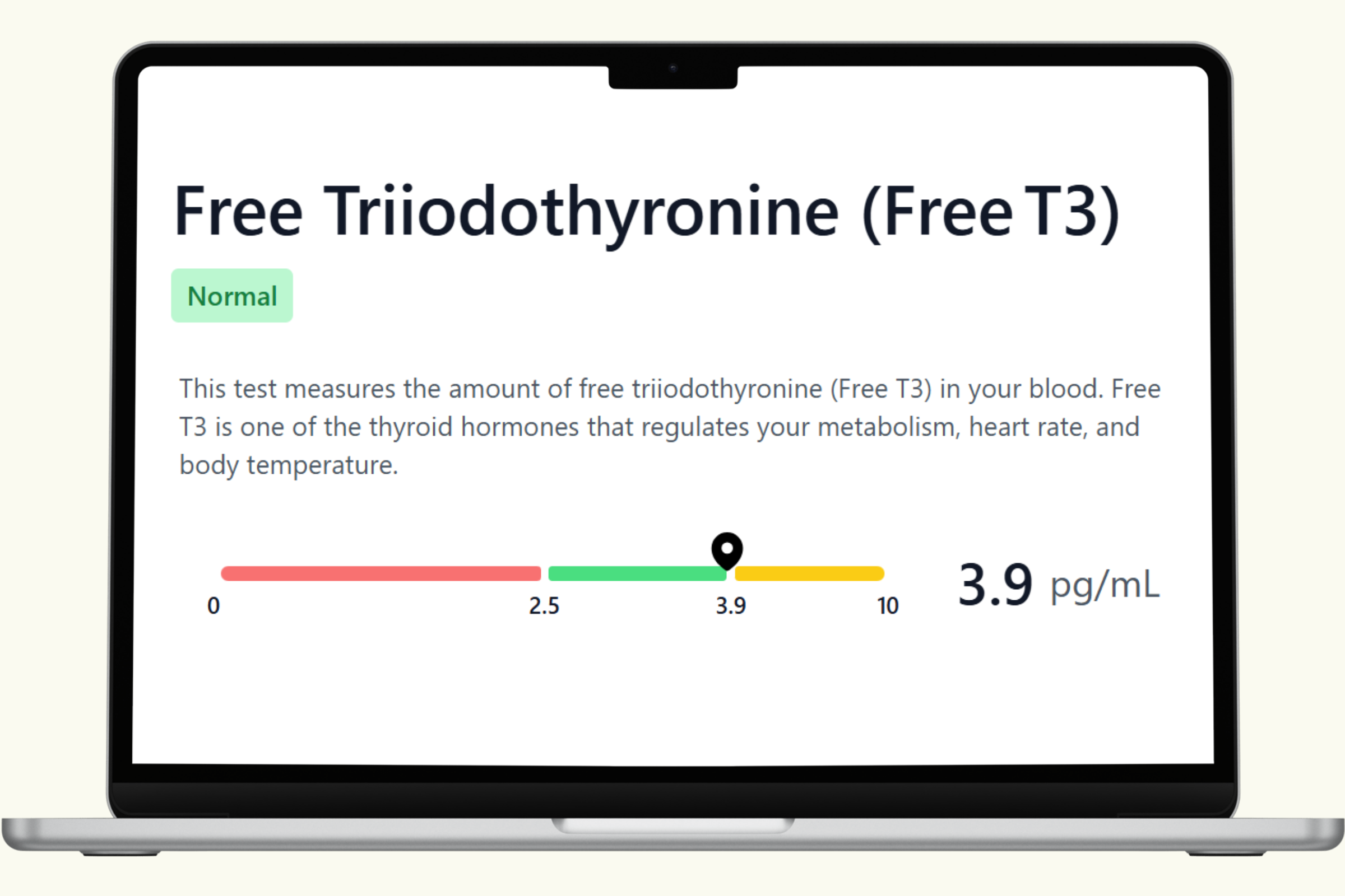 Free T3 Blood Test