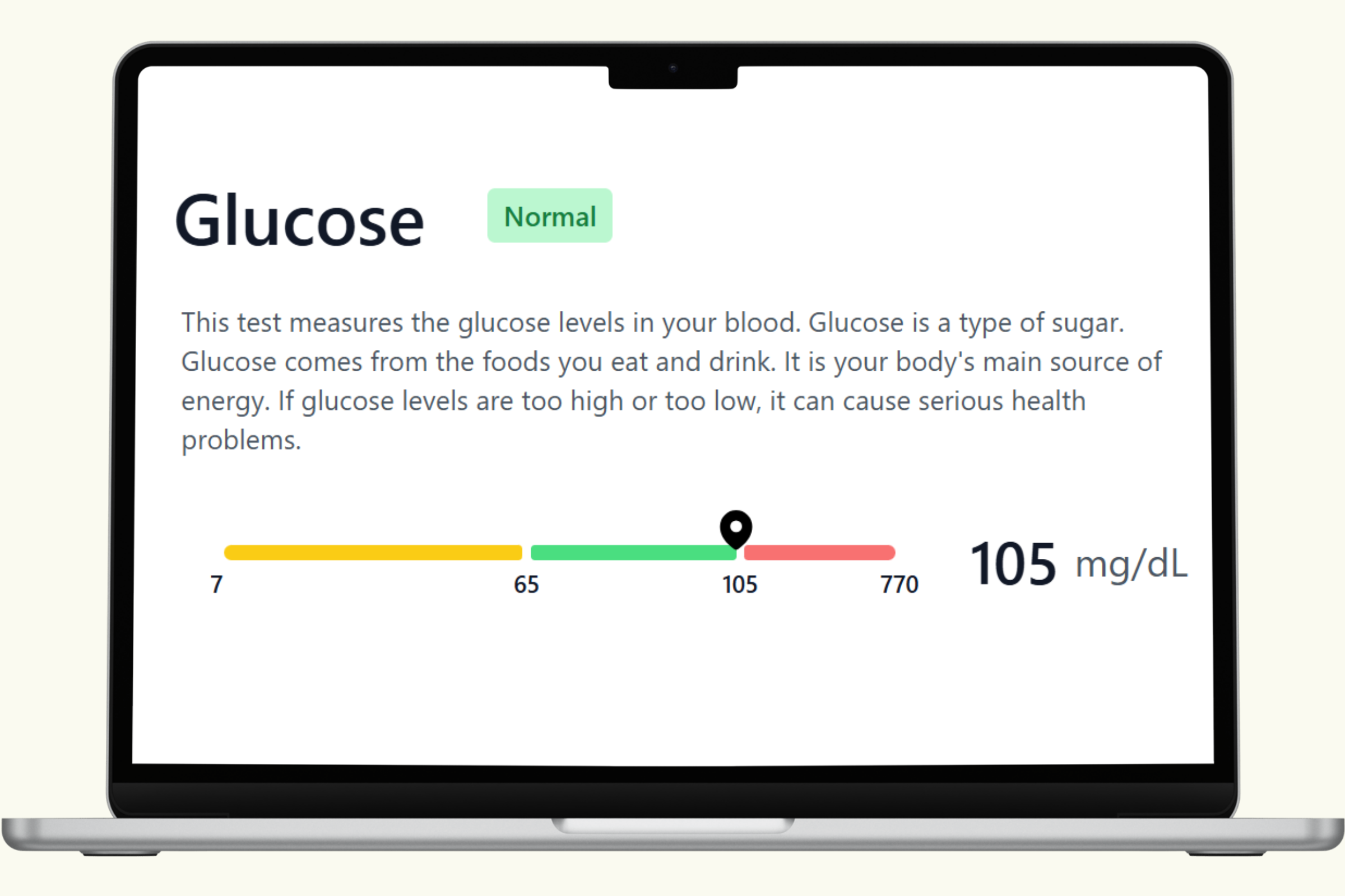 Glucose Blood Test