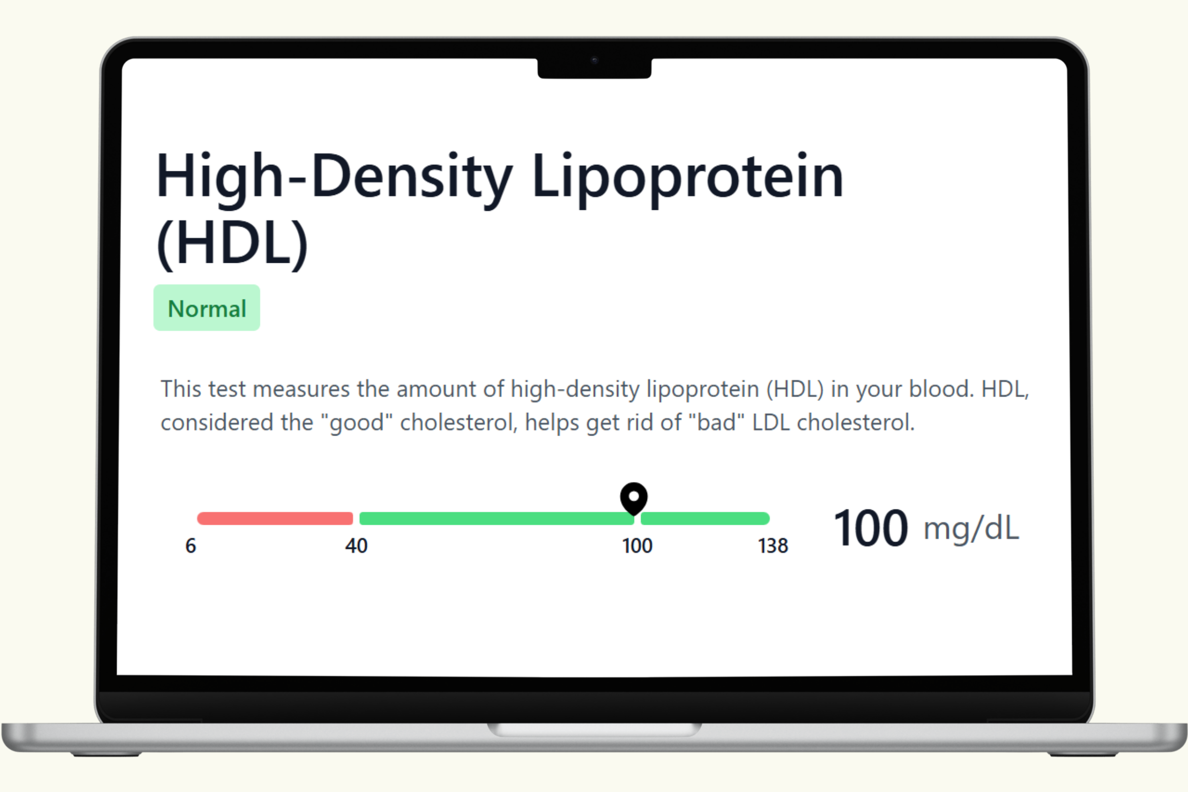 HDL Blood Test