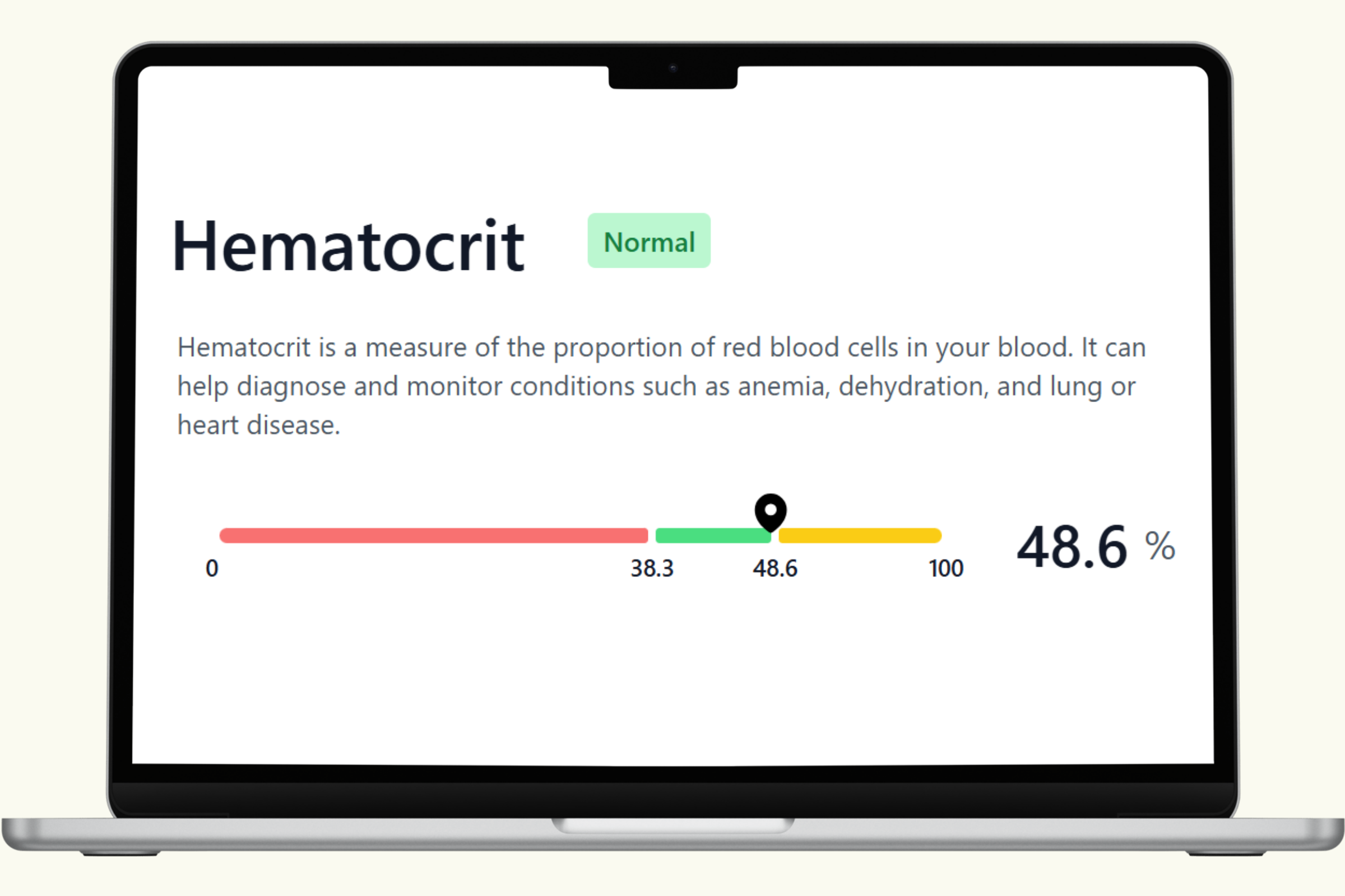 Hematocrit Blood Test