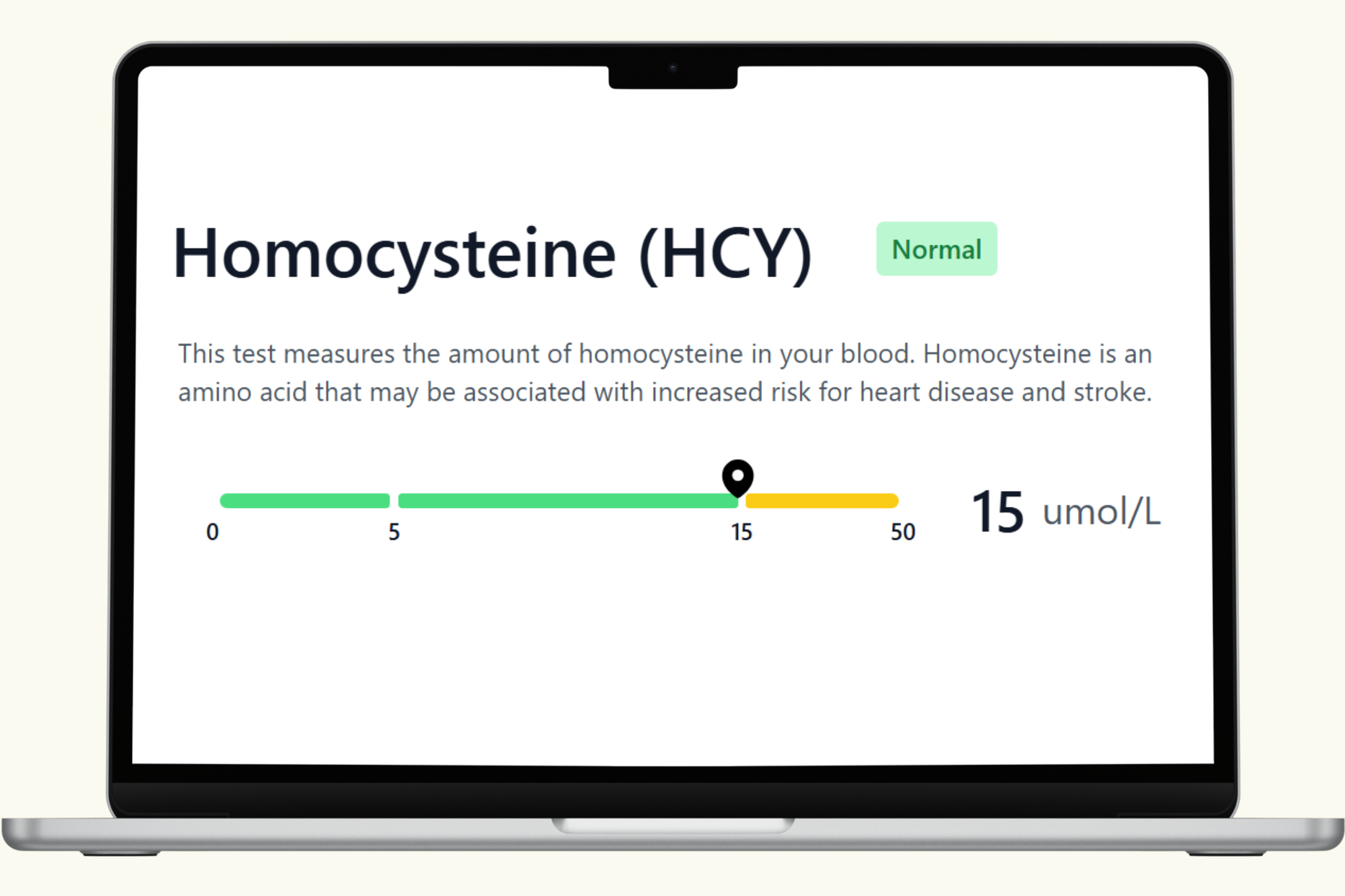 Homocysteine Blood Test