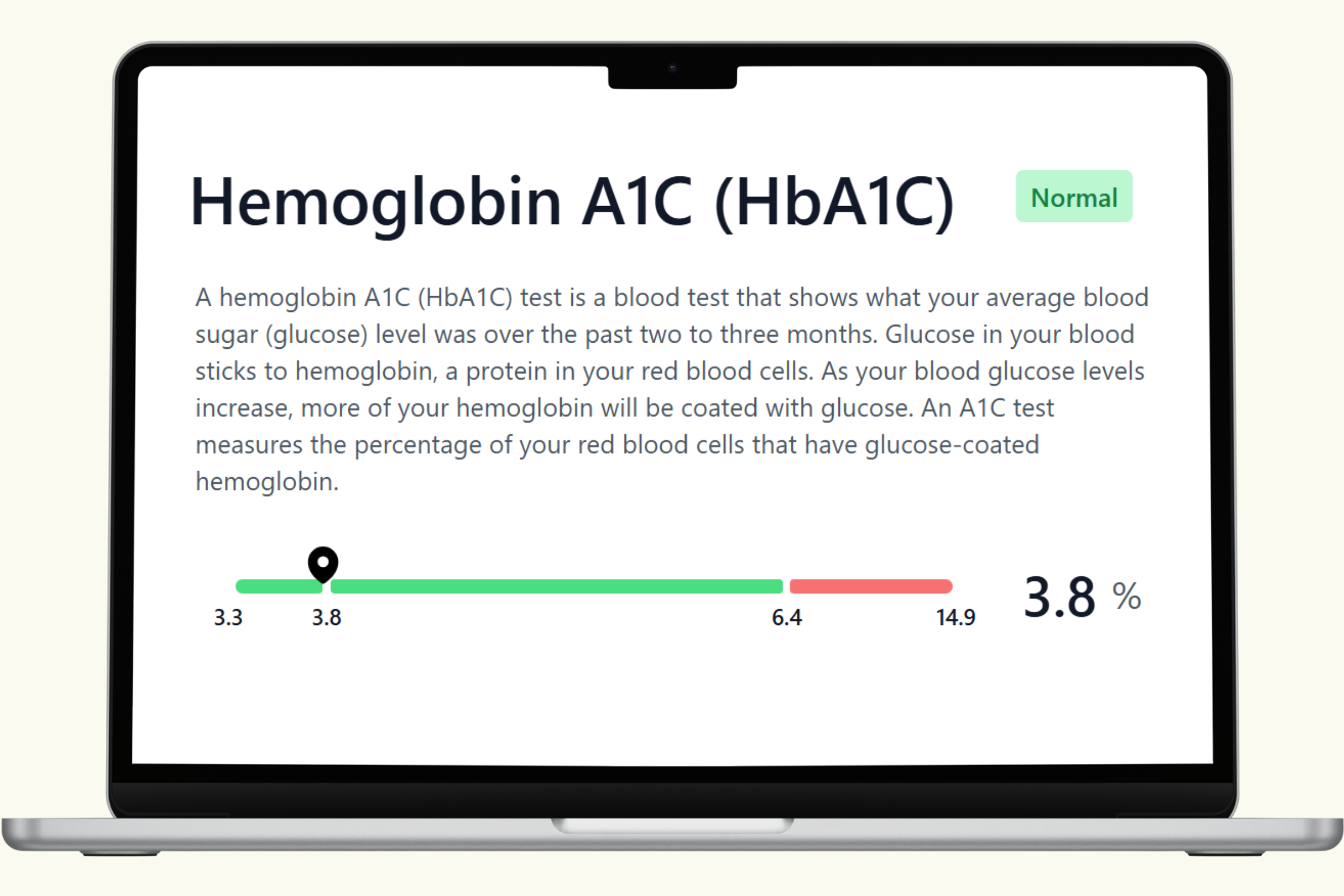 HbA1C Blood Test