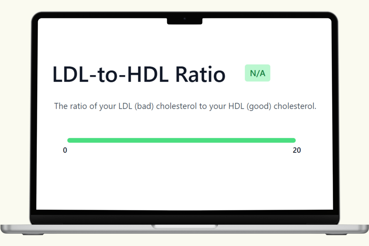 LDL-HDL Ratio Blood Test – PlexusDx