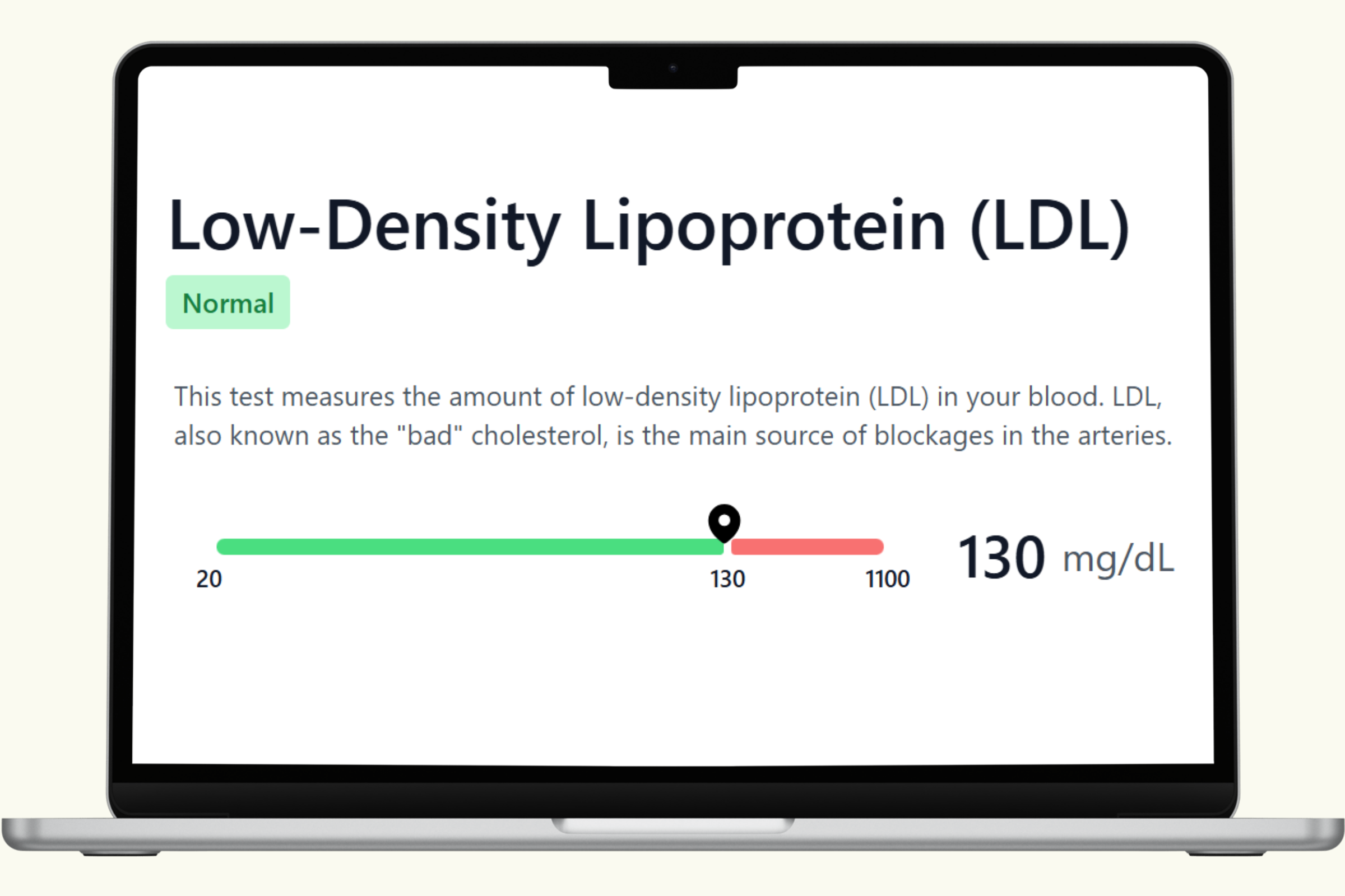 LDL Blood Test
