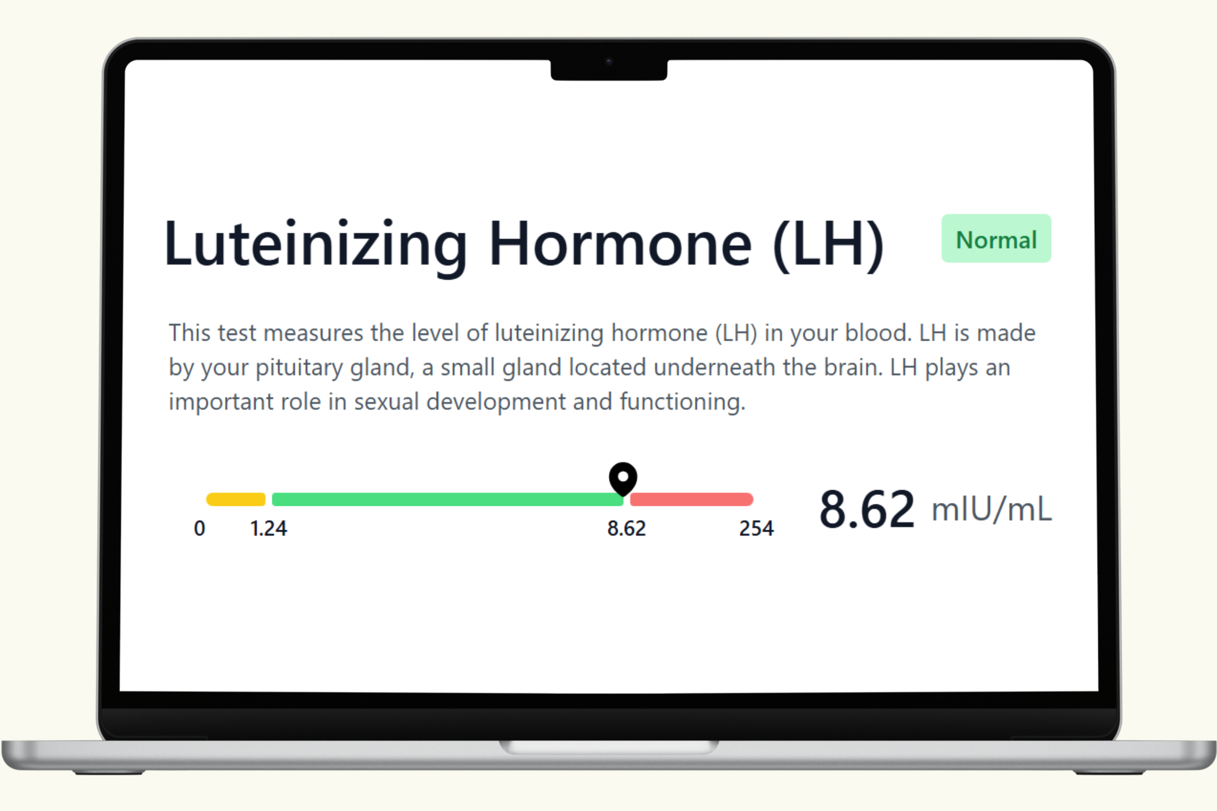 Luteinizing Hormone (LH) Blood Test