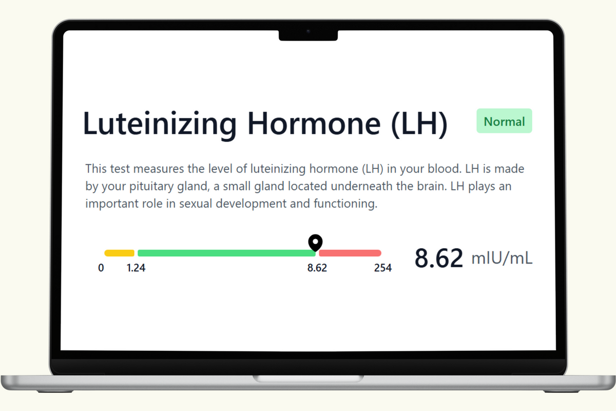 Luteinizing Hormone (LH) Blood Test - Men's Health & Wellness Panel ...