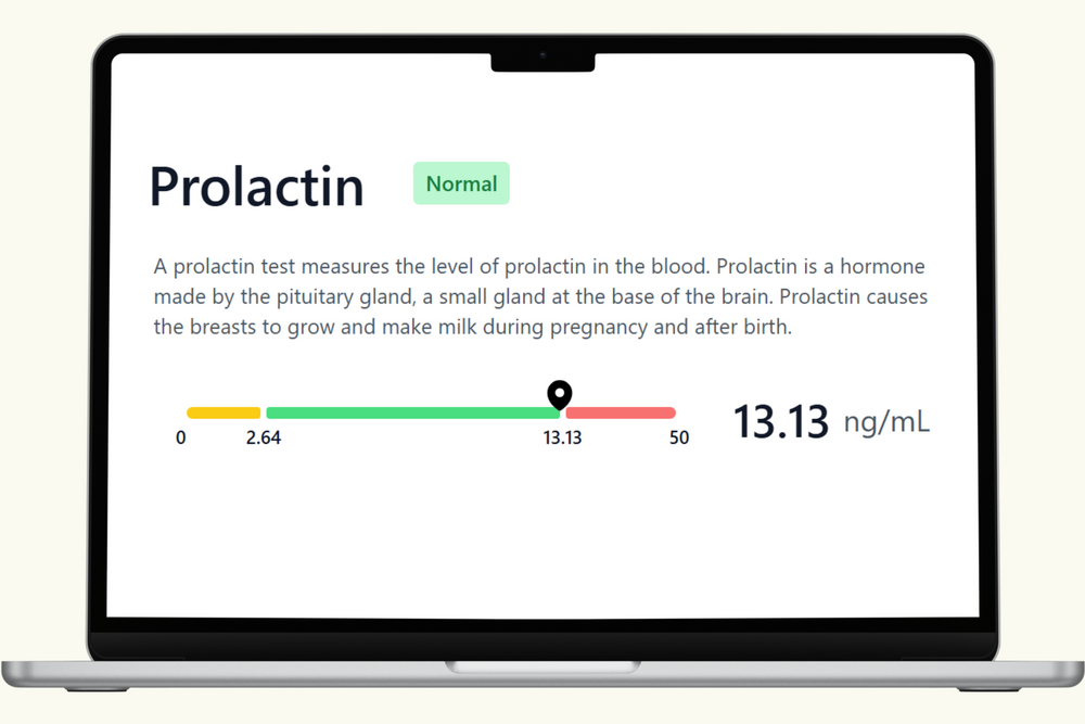 Prolactin (PRL) Blood Test - Women's Fertility Biomarkers – PlexusDx