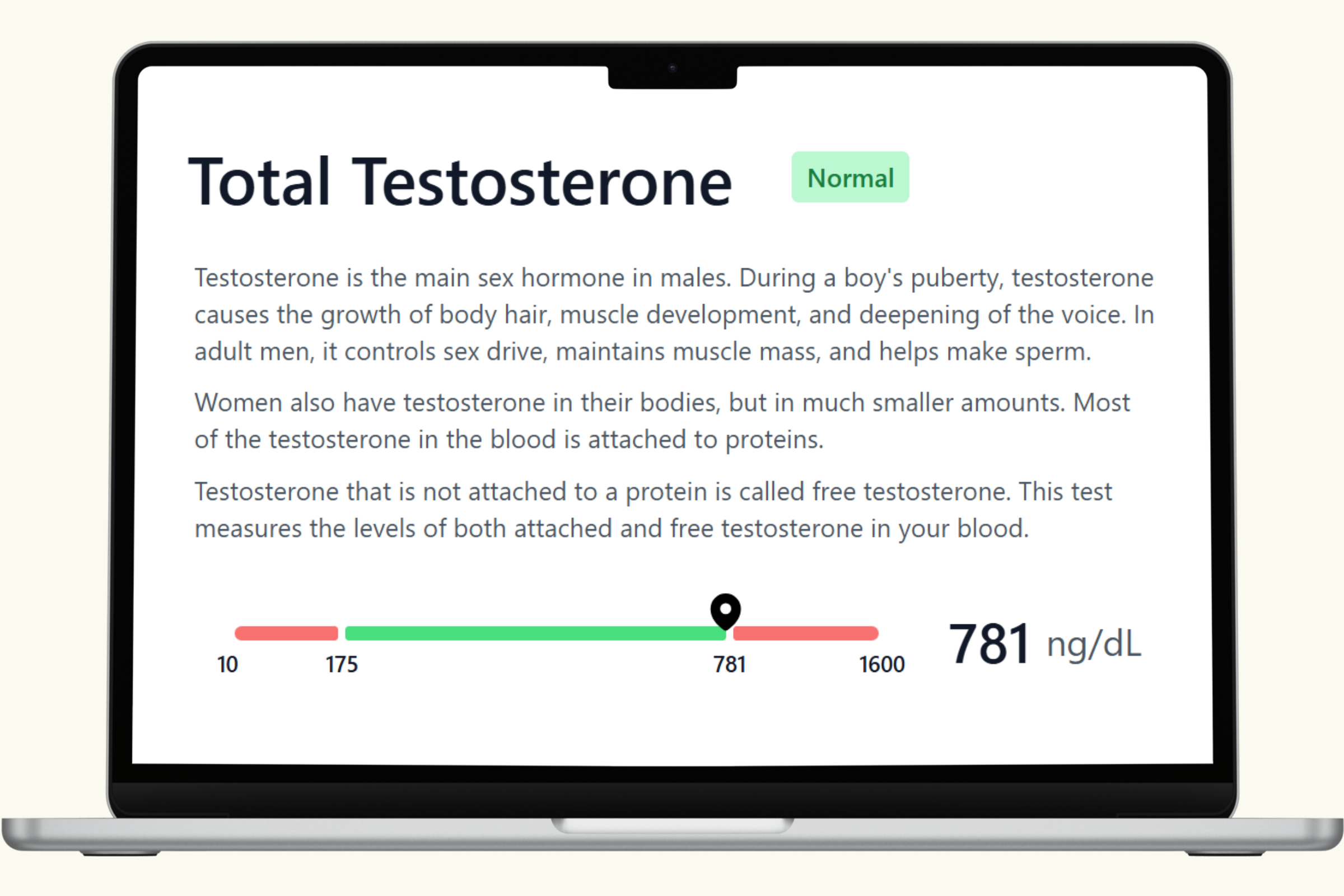Testosterone Blood Test