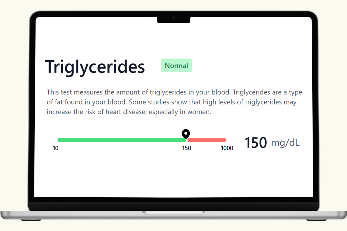 Triglycerides Lab Test Triglycerides Blood Test – PlexusDx