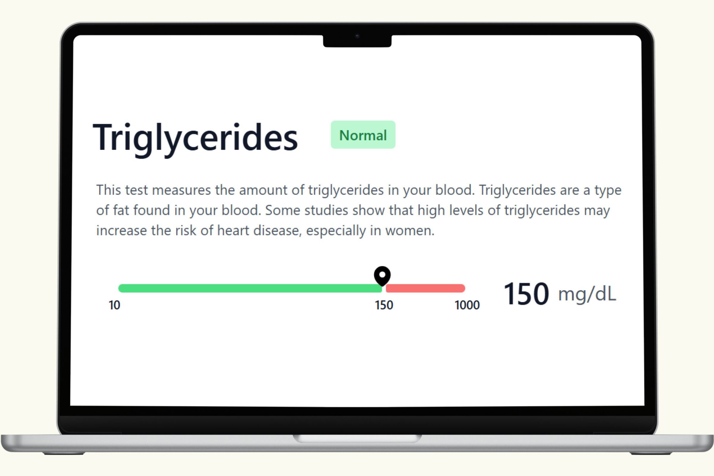 Triglycerides Blood Test