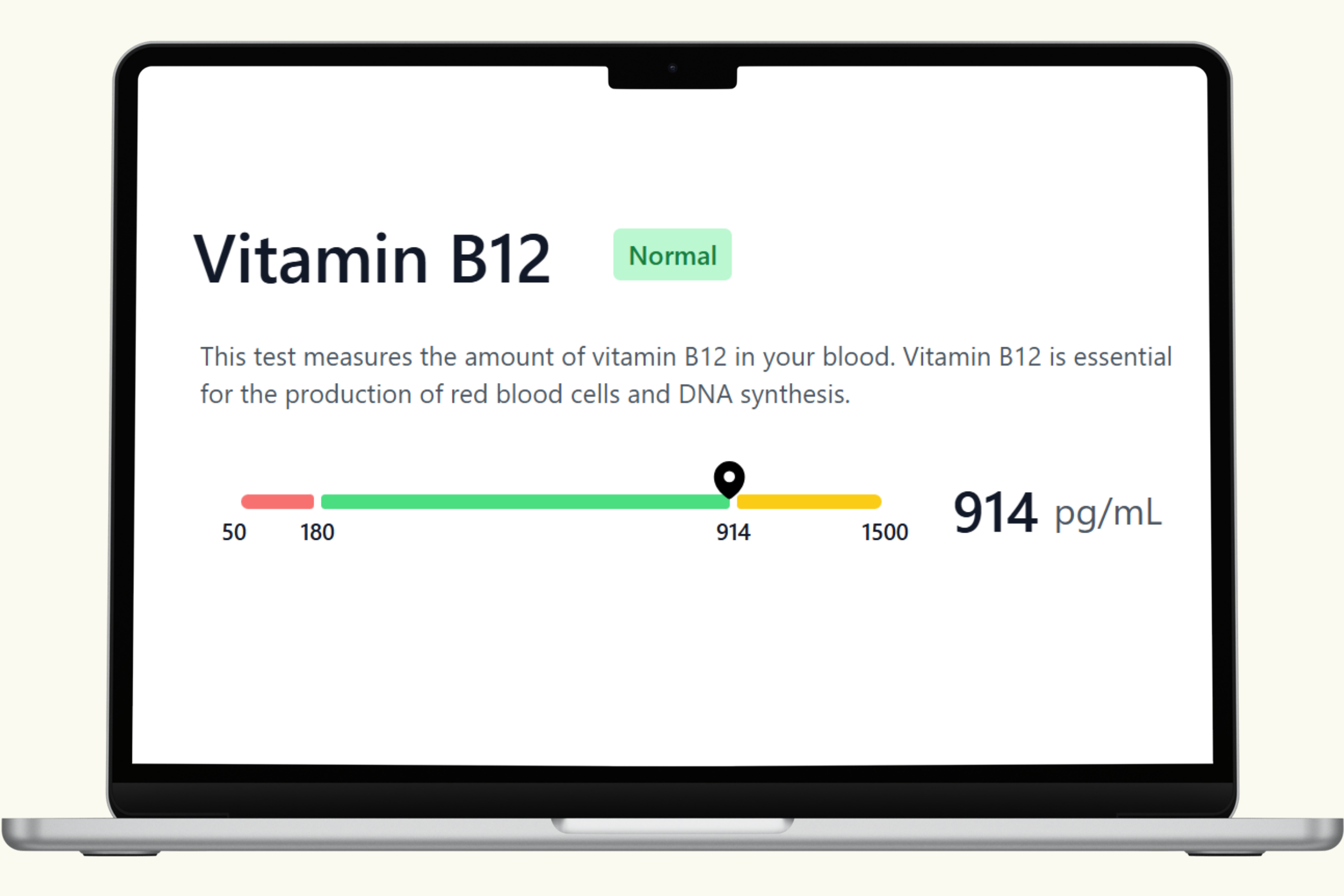 Vitamin B12 Blood Test