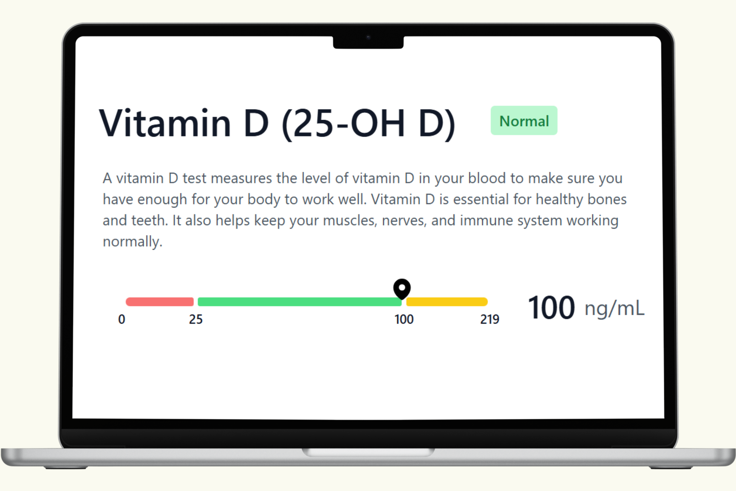 Vitamin D Blood Test